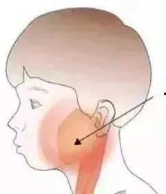 腮腺炎可以吃瓜吗,瓜类食物的适宜与禁忌