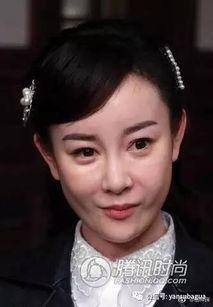 吃瓜整容的明星,揭秘整容背后的真相与争议